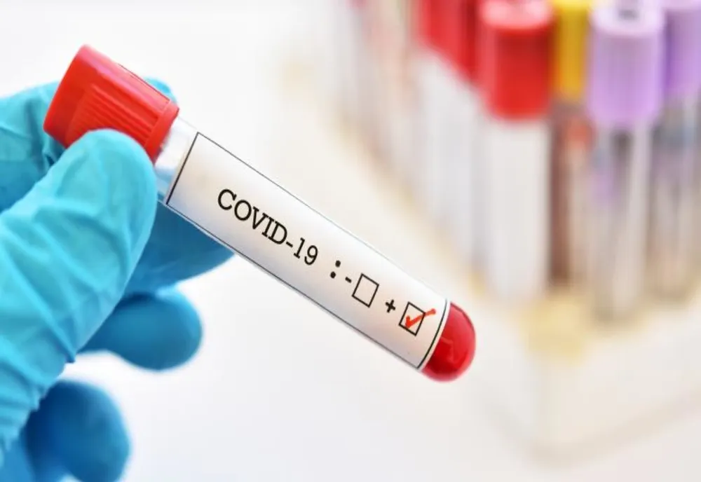 101 cazuri confirmate cu COVID-19 în Mehedinți 