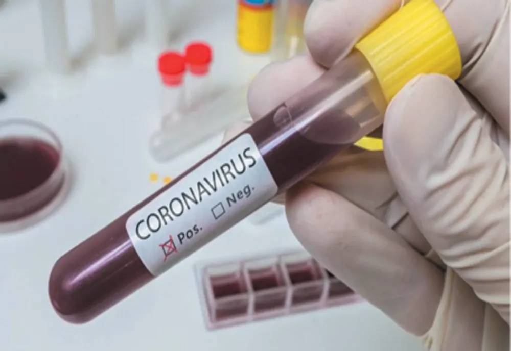 Doi angajaţi ai Direcţiei Cadastru din cadrul Primăriei Drobeta Turnu Severin au fost diagnosticaţi cu Covid-19