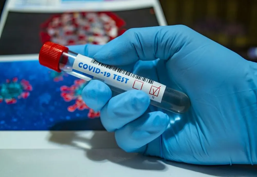 Aproape 5.500 de cazuri noi de infectare cu SARS-COV-2 și peste 300 de decese