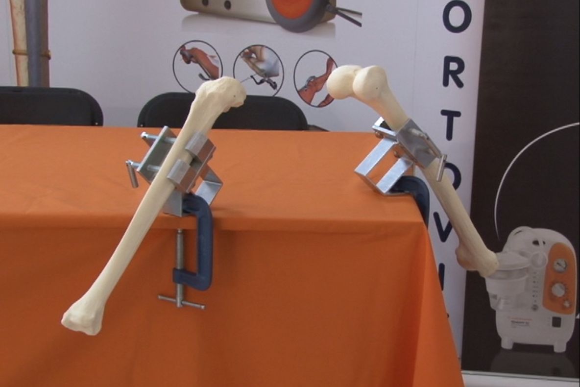 ELITA ORTOPEDIEI DIN OLTENIA, LA SEVERIN