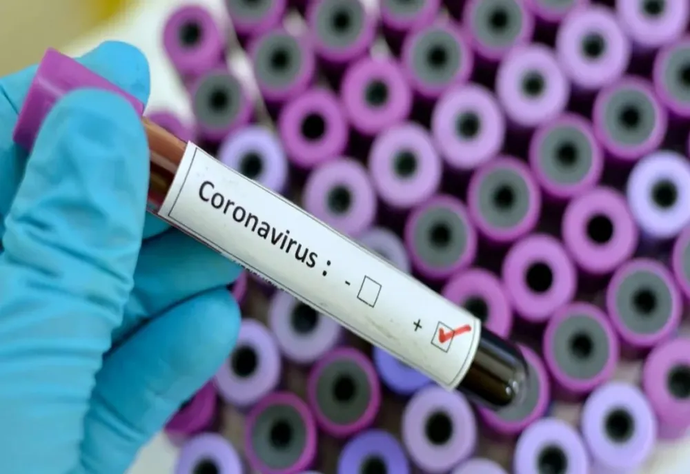 27 de cadre medicale confirmate pozitiv cu COVID-19