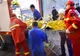 O tânără de 17 ani din Mehedinți a fost incendiată cu motorină, de un deținut eliberat condiționat
