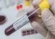 Doi angajaţi ai Direcţiei Cadastru din cadrul Primăriei Drobeta Turnu Severin au fost diagnosticaţi cu Covid-19